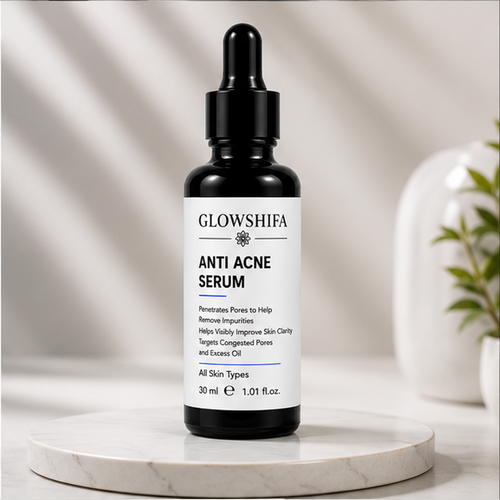 GLOWSHIFA Face Serum, Helps Fight Acne, Calms Redness, Prevents Breakouts, 30 ml (Anti Acne Serum)